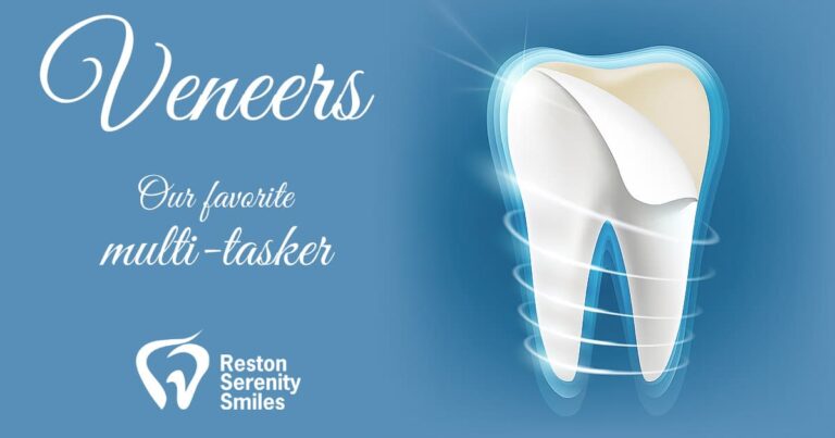 Porcelain Veneers