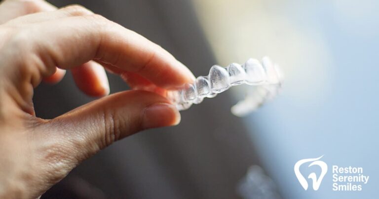 clear aligners