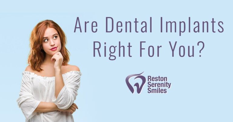 Dental Implants