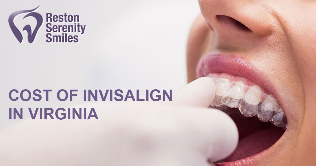 Explore Invisalign® Cost in Virginia Make the Right Choice