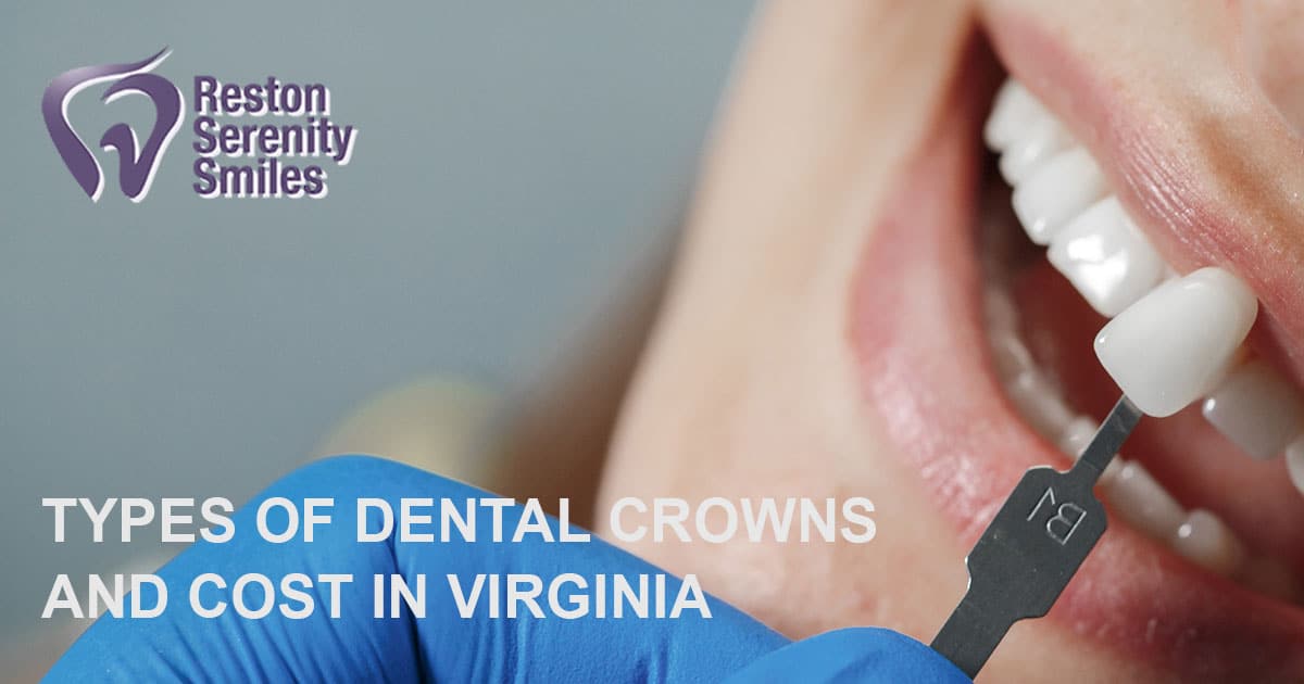 Types of Dental Crowns and Cost Choose the Right Option