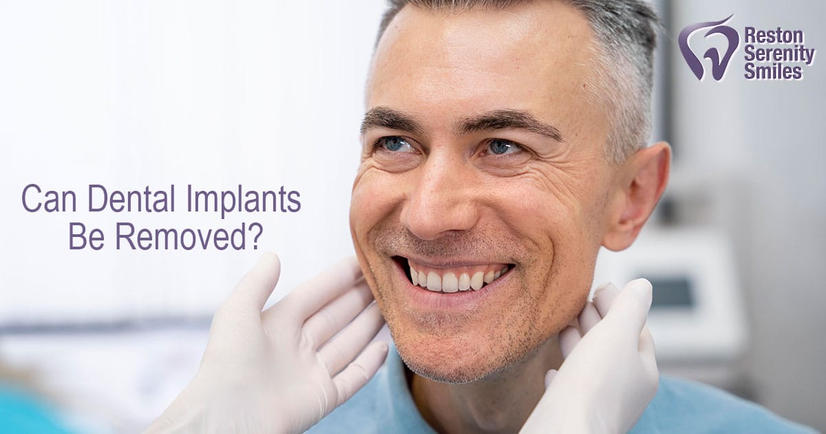 Can Dental Implants be Removed and Replaced With Dentures